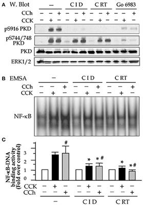 Novel Small Molecule Inhibitors of Protein Kinase D Suppress NF-kappaB Activation and Attenuate the Severity of Rat Cerulein Pancreatitis